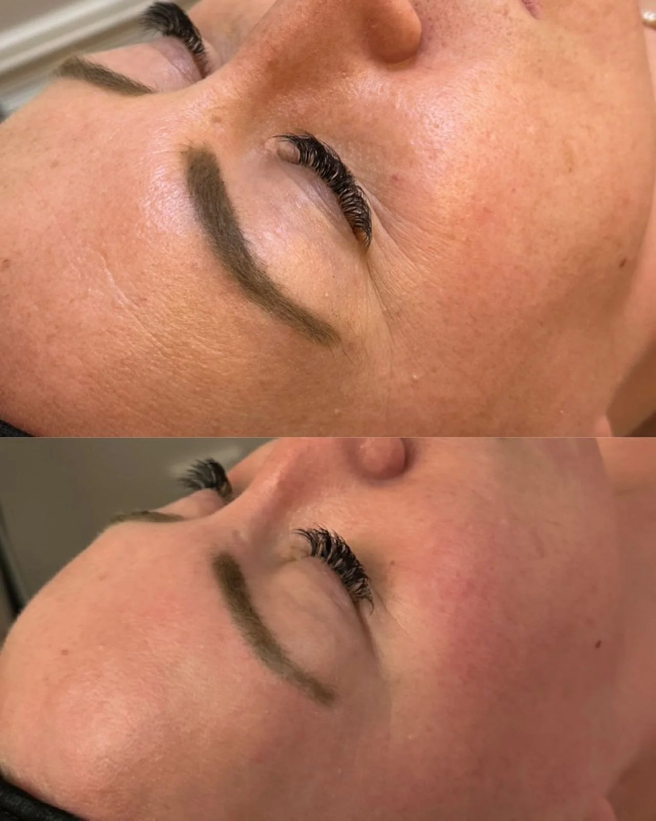 1x full face lift + vitamin C facial 🧡💆🏼&zwj;♀️

No filter or editing! 🤩

The full face lift works on your future skin - boosts collagen &amp; elastin production in the skin! You can literally see the results within minutes! And the best part is 