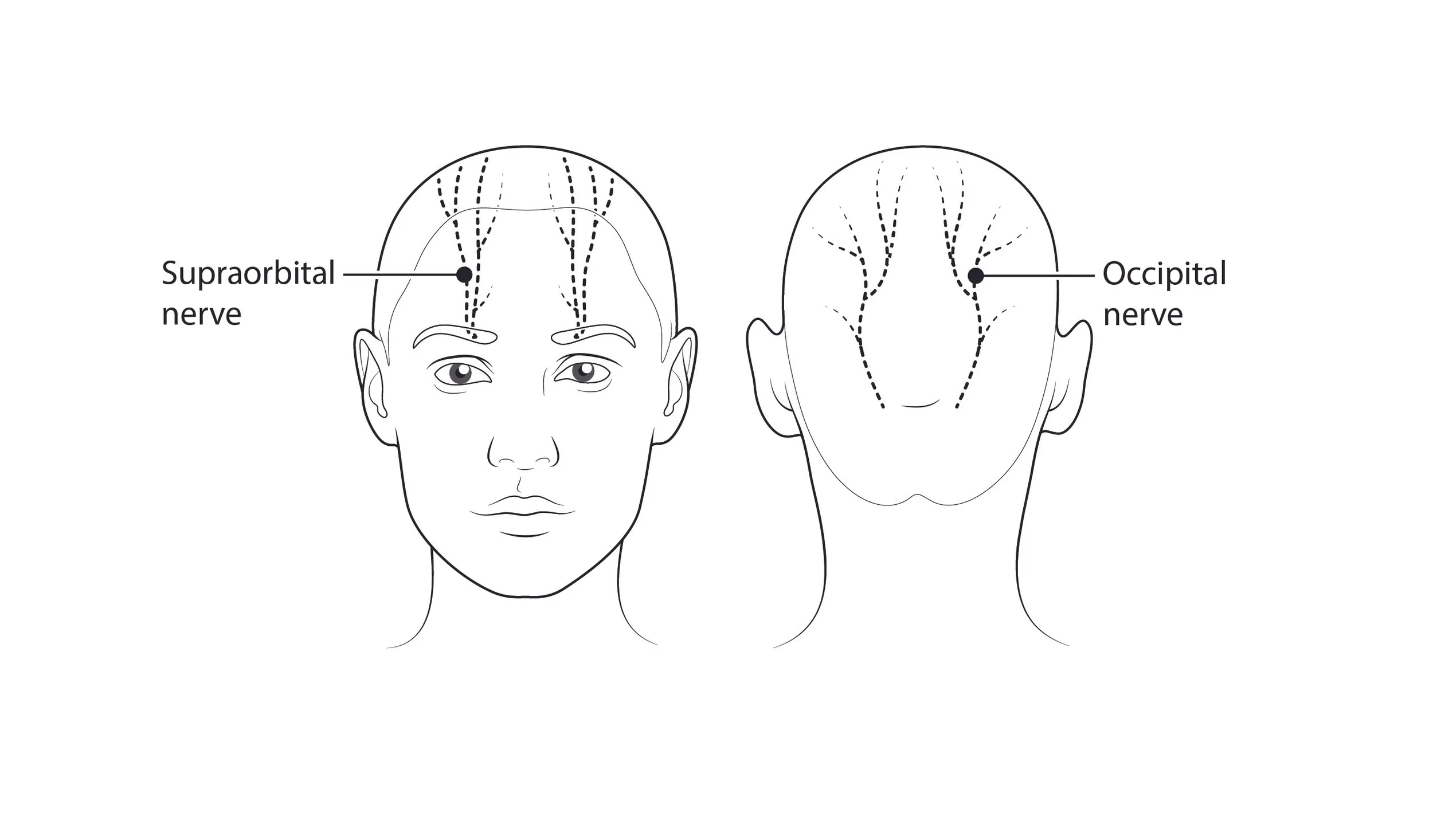 Nerves image 12-12-24.jpg