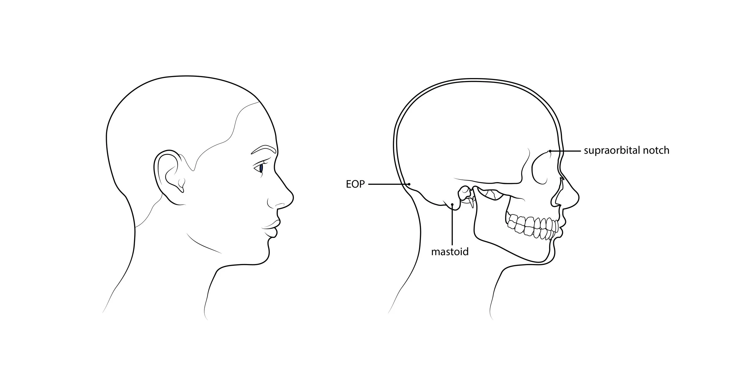surgery steps examples-01.jpg