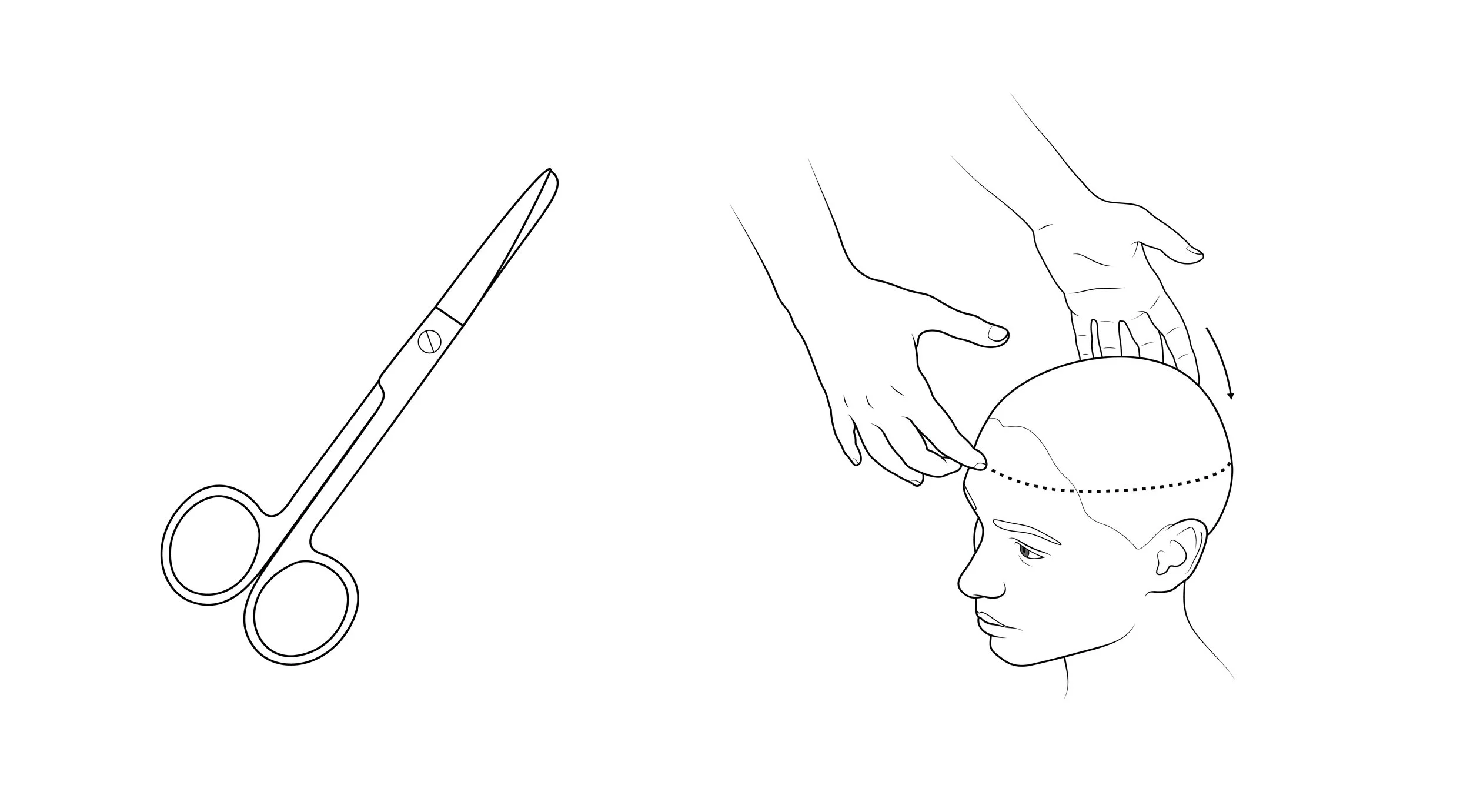 surgery steps examples-02.jpg