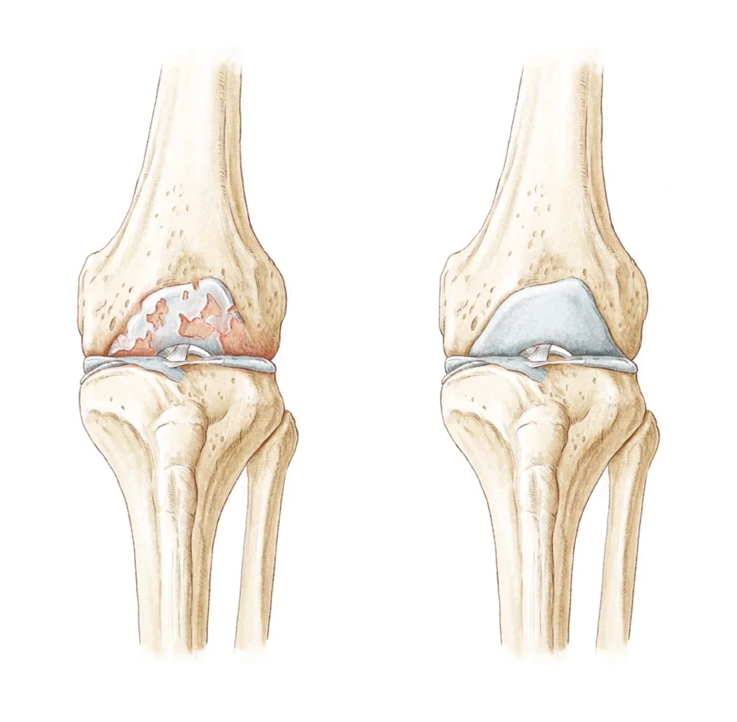 Medizinische Illustration – Gesundheitsplattform TCS