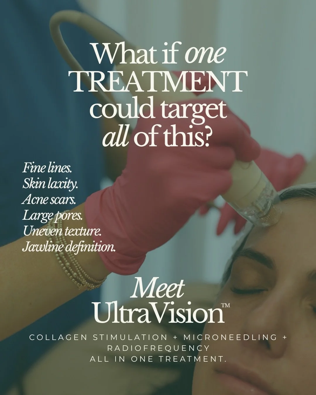 UltraVision takes things a step further by using ultrasound technology to let our providers see and measure what&rsquo;s happening beneath your skin before treatment. This helps us customize your treatment based on your unique skin and goals!

Think 