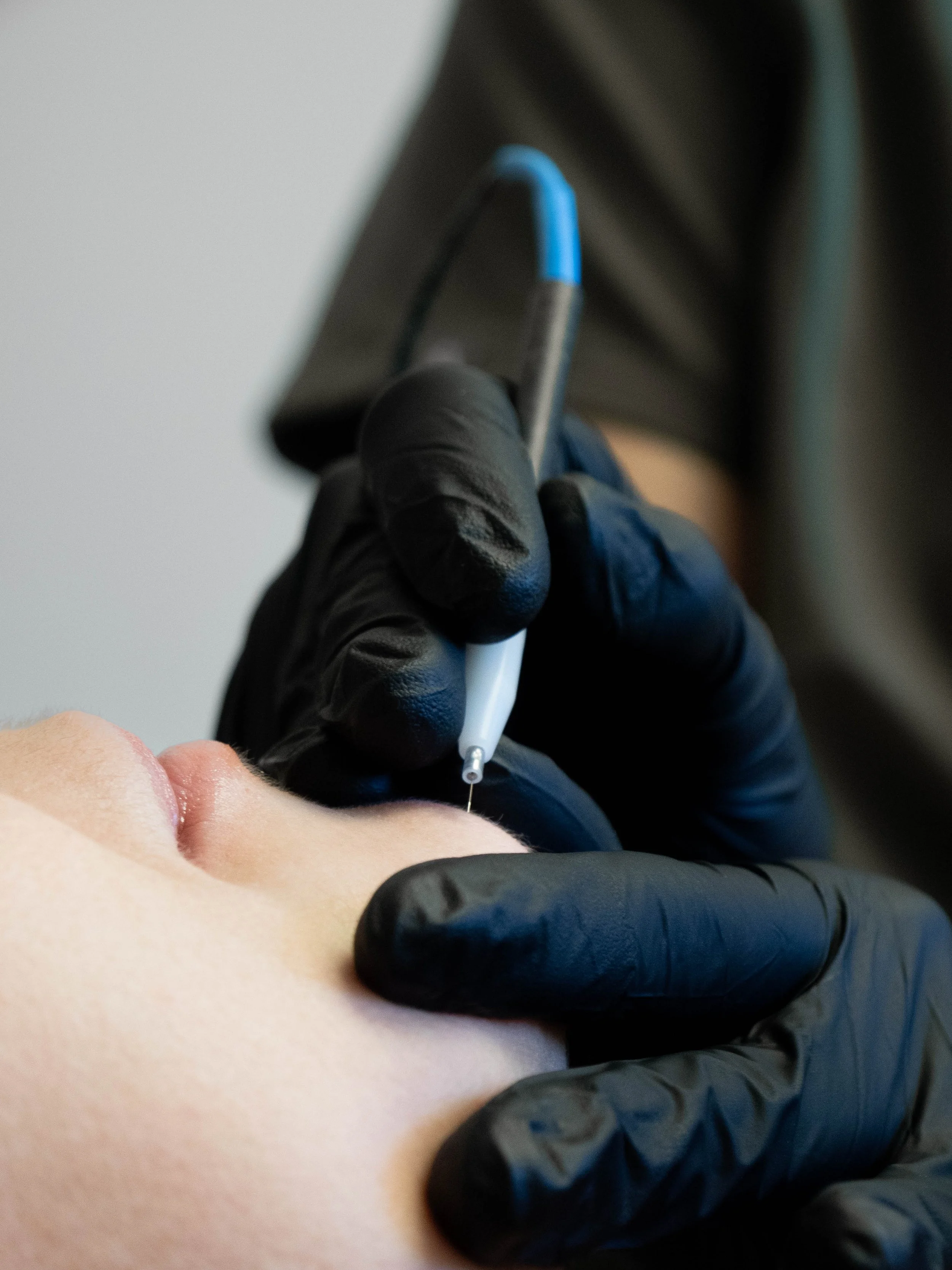 Epilation-electrique-Aix-en-Provence.jpg