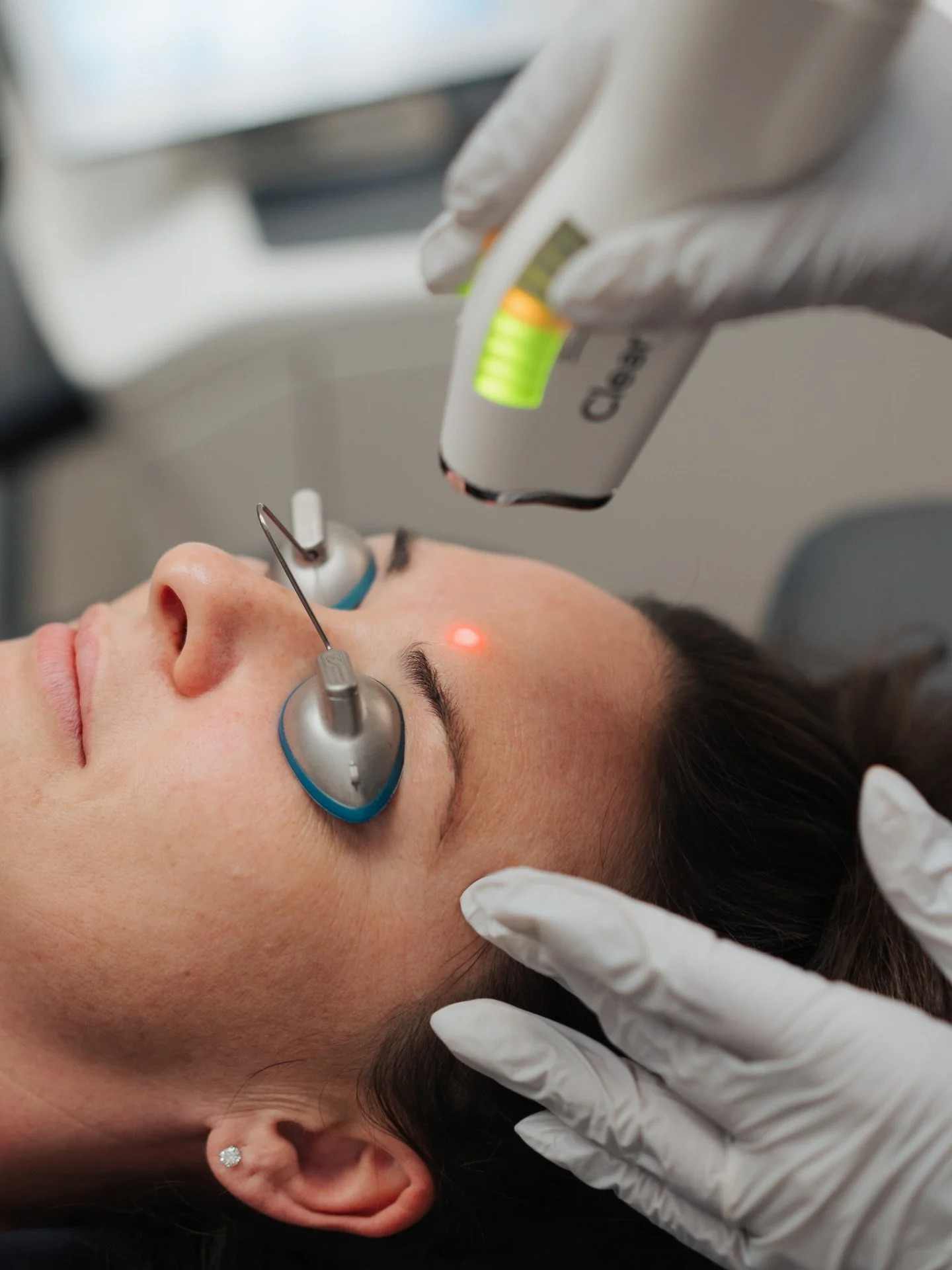 ClearSilk is one of our favorite treatments for patients who want healthier, brighter skin without downtime.

This gentle laser works below the surface of the skin, stimulating collagen and your body&rsquo;s natural repair process for gradual skin re