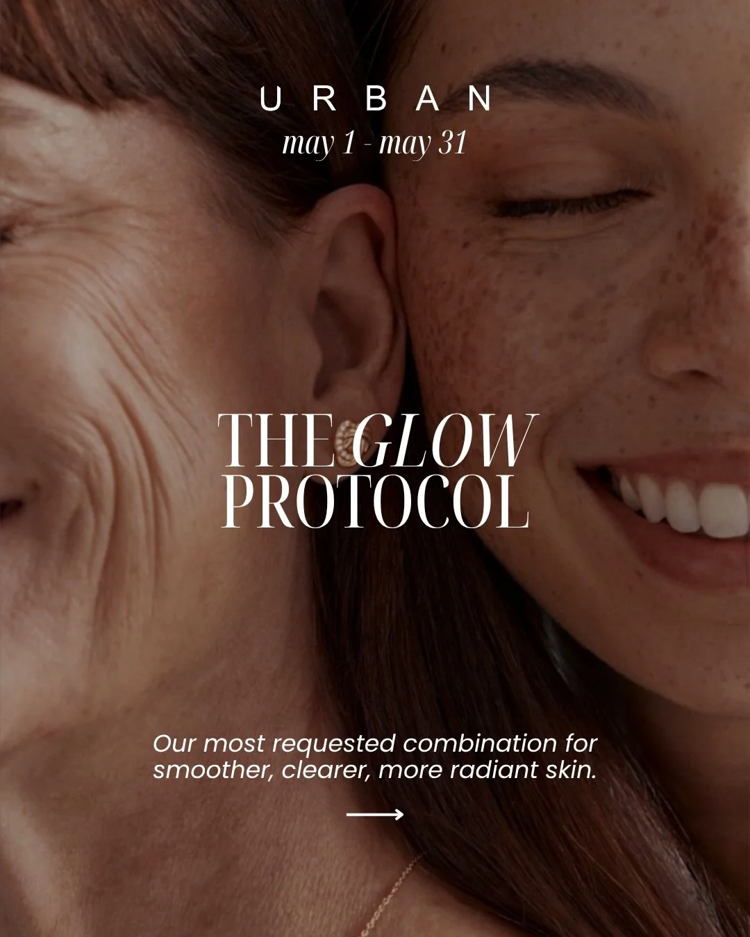 This one&rsquo;s for the moms 🤍

You do everything&hellip;consider this your sign to do something for you!

Pairing a VI Peel with tox in the same visit, is our favorite &ldquo;tox booster&rdquo; this duo enhances results by treating the skin on mul