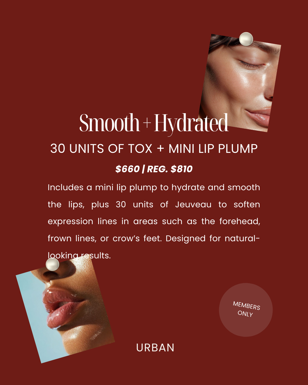 February Aesthetic Treatment Specials - URBAN Medical - Gilbert, AZ, and Fishersville, VA.