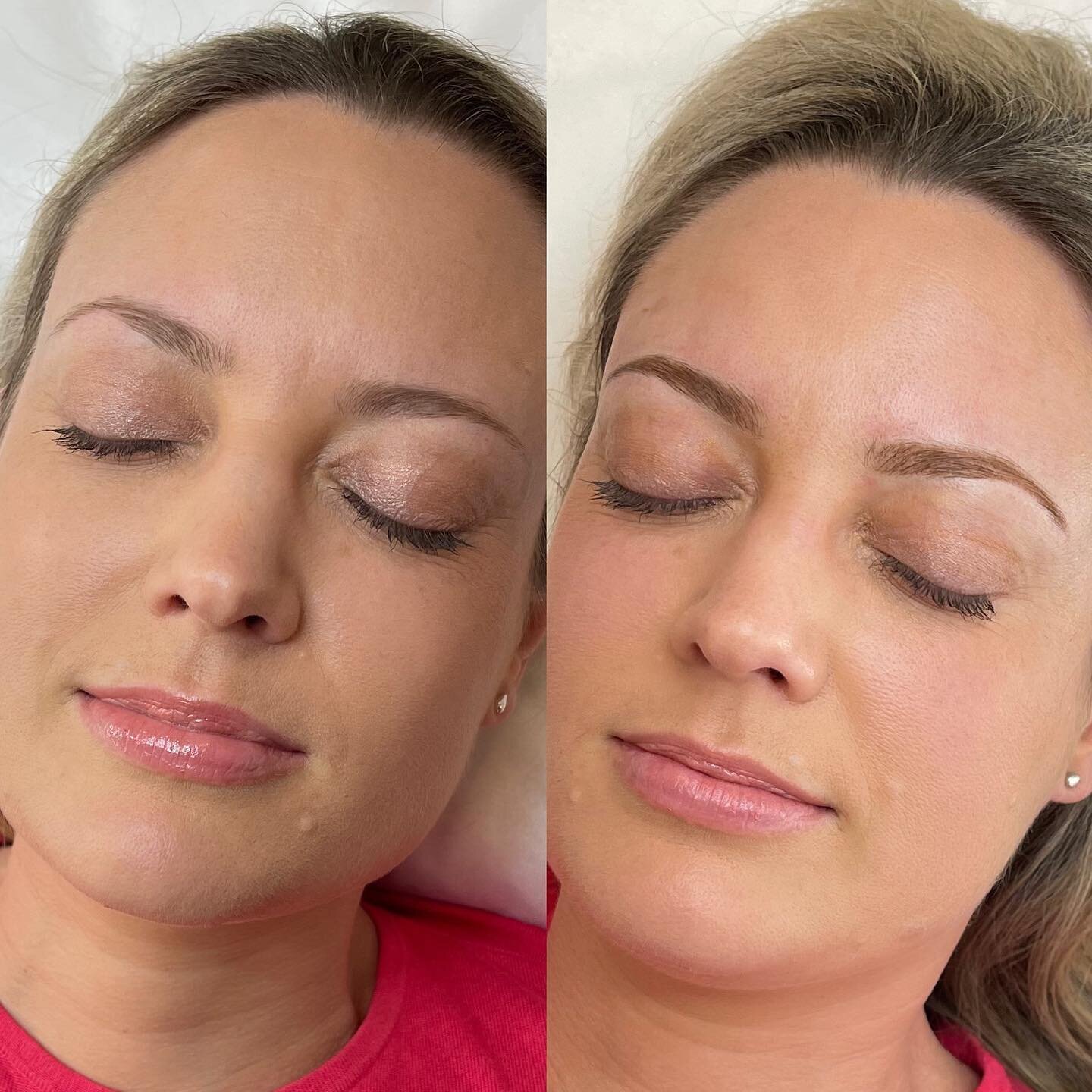 Our approach to cosmetic tattoo is less is more, we love a subtle enhancement.  Bespoke Ombr&eacute; powder brows proving how natural this technique can look depending on your preferred outcome 🫶🏽

What are Powder Brows? 

- Powder brows is a semi-