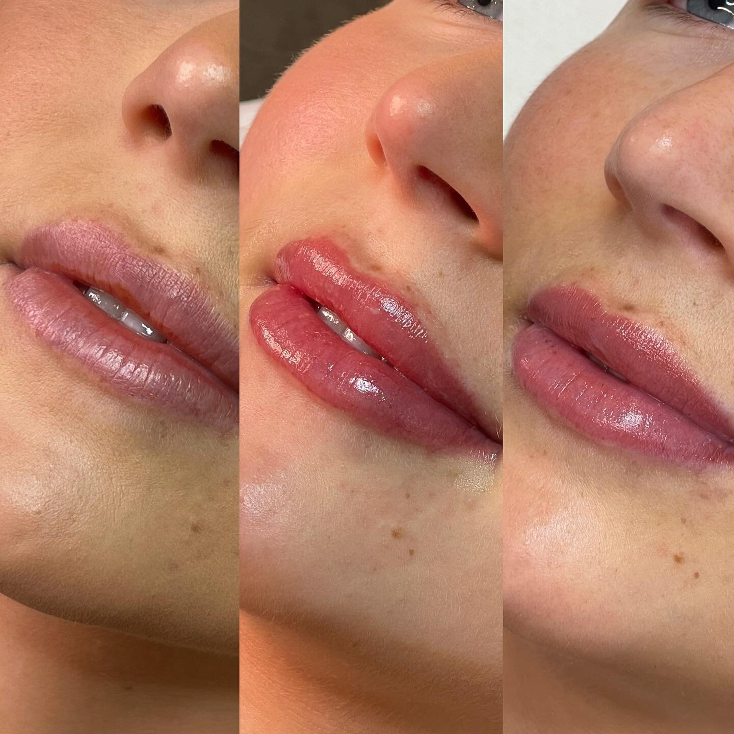 Natural Lip Blush - Your lips but better 🫦

Before | Immediately After | Fully Healed 

&bull; Lip blush is perfect for those who have lost their natural lip pigment, unevenness and want to accentuate the lips naturally. 

&bull; Naturally stimulate