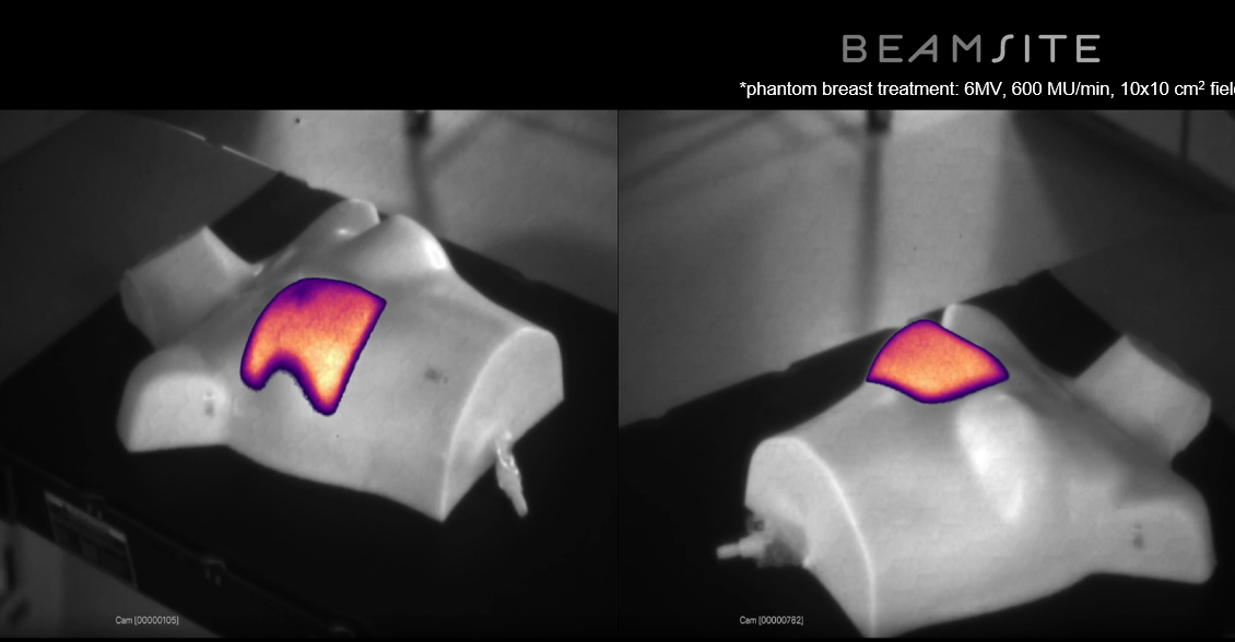 BeamSite: A New Paradigm in Radiation Delivery