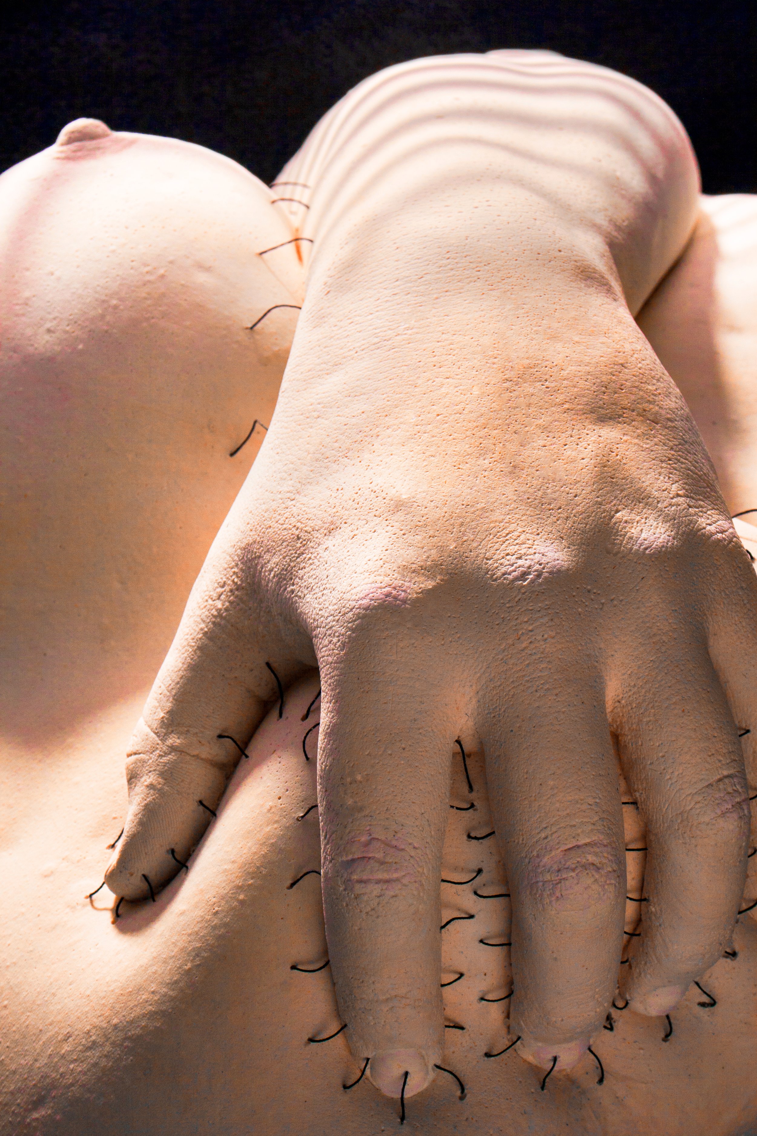 Stitches 1.jpg