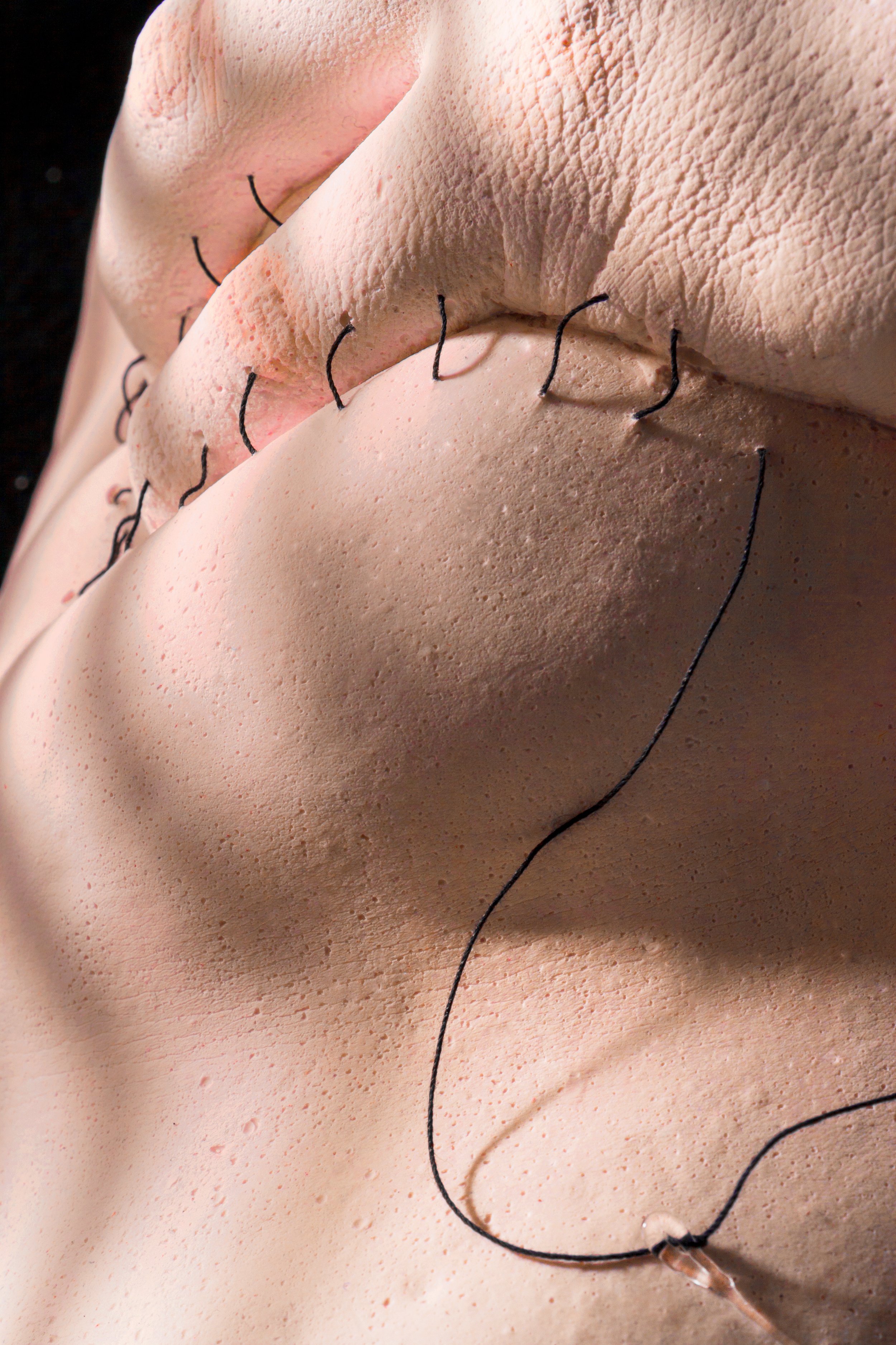 Stitches 3.jpg