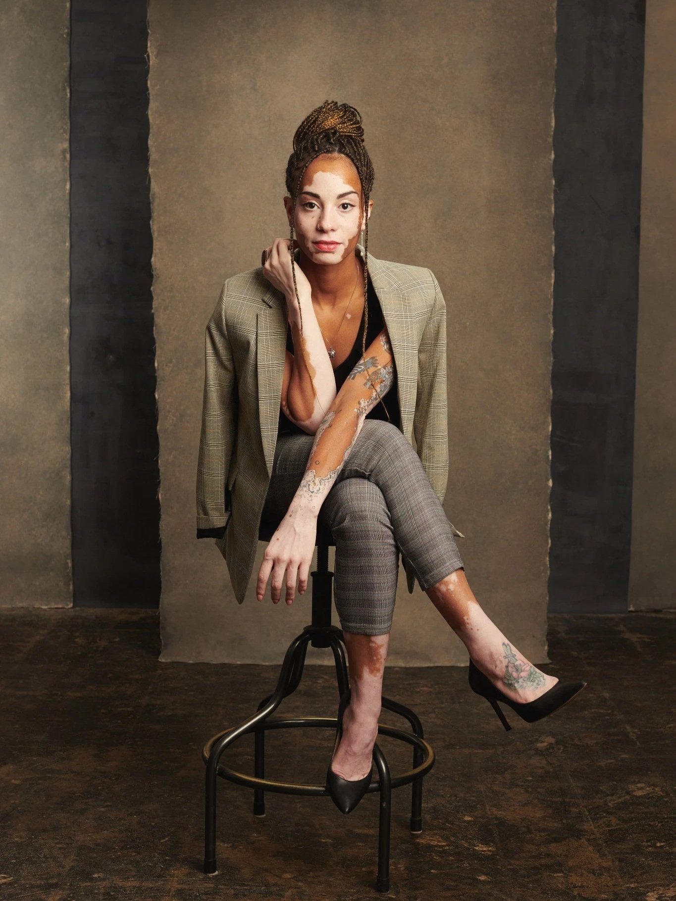 A woman with partial vitiligo and tattoos on her legs, sitting on a stool, wearing a plaid blazer and plaid pants, with her left hand resting on her face, in front of a neutral background.