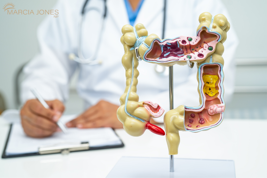 Digestion From Top To Bottom