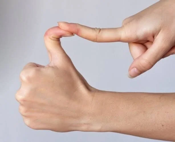 Bendy for a Reason: Understanding Ehlers-Danlos Syndrome