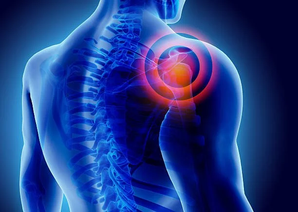 What Causes Shoulder Pain? A Specialist's Overview