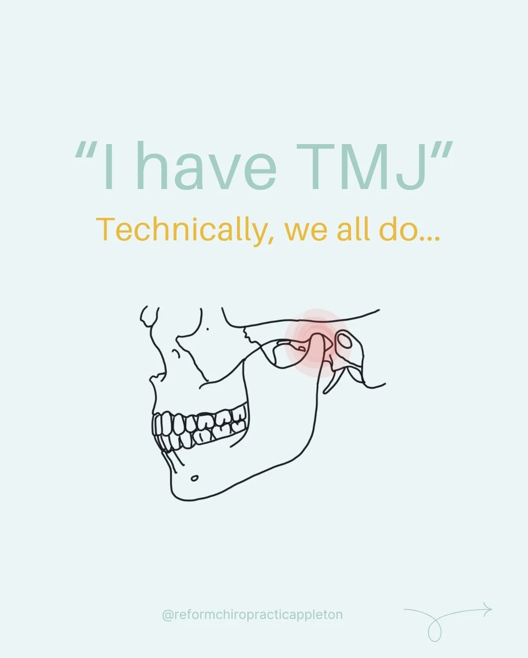 &ldquo;I have TMJ.&rdquo;

Well&hellip;technically we all do.😅

TMJ (short for temporomandibular joint) is just the joint that connects your jaw to your skull. So if you have a jaw, you have a TMJ.

What most people are usually talking about is TMD 