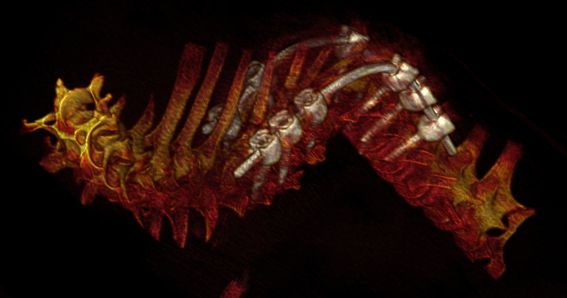 PNG image.png