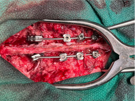 Leo in surgery.png