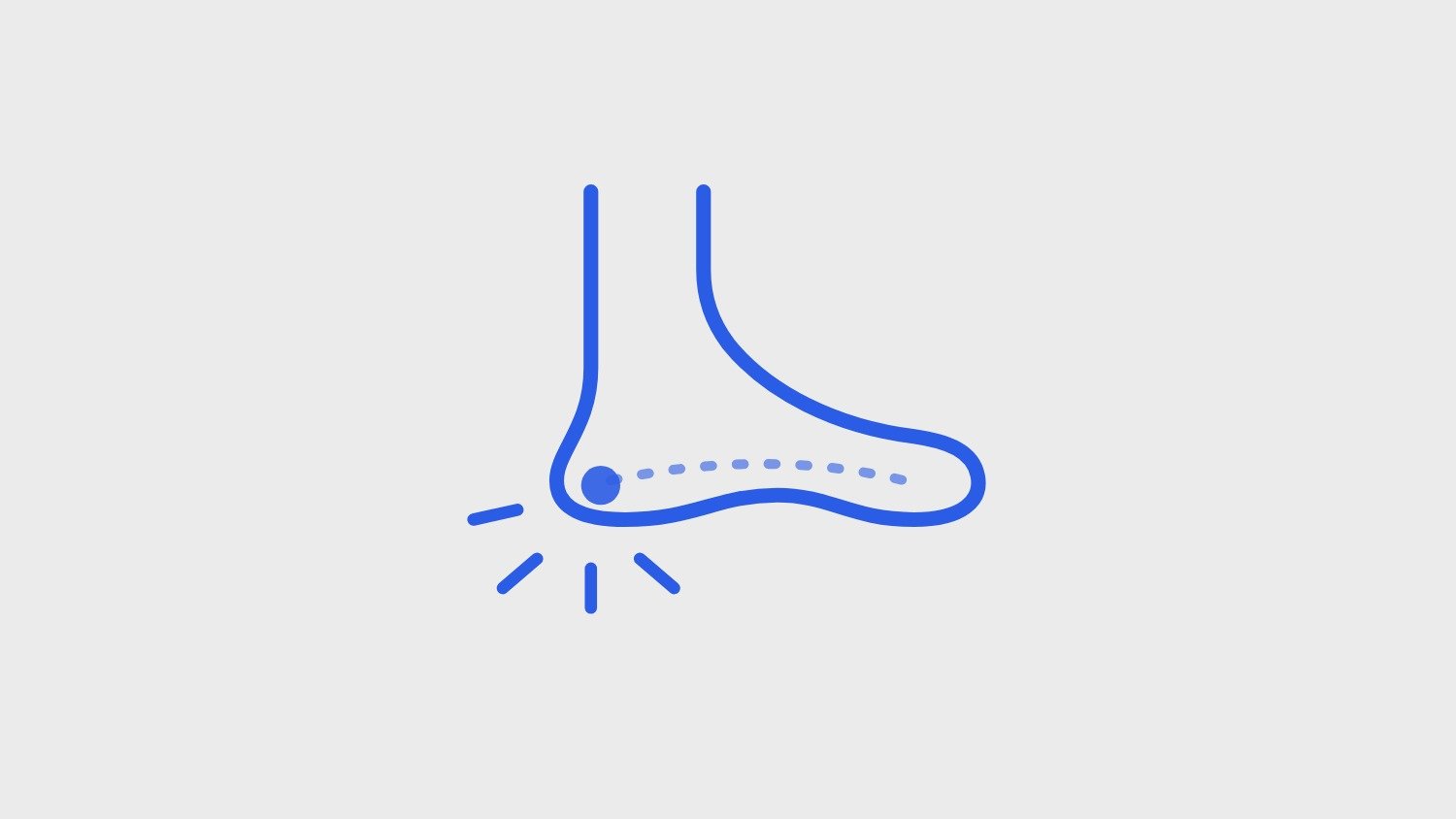 Plantar Fasciitis: Why Stretching Alone Isn't Fixing Your Heel Pain