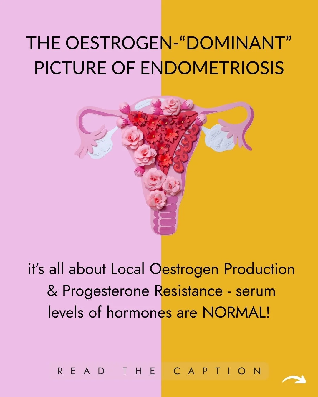 Endometriosis is a chronic inflammatory condition- where endometrial “like”(it is NOT endometrial itself) tissue is found body wide, causing a variable range of manifestations & symptoms form pain to mood and everthing inbetween. 
Th