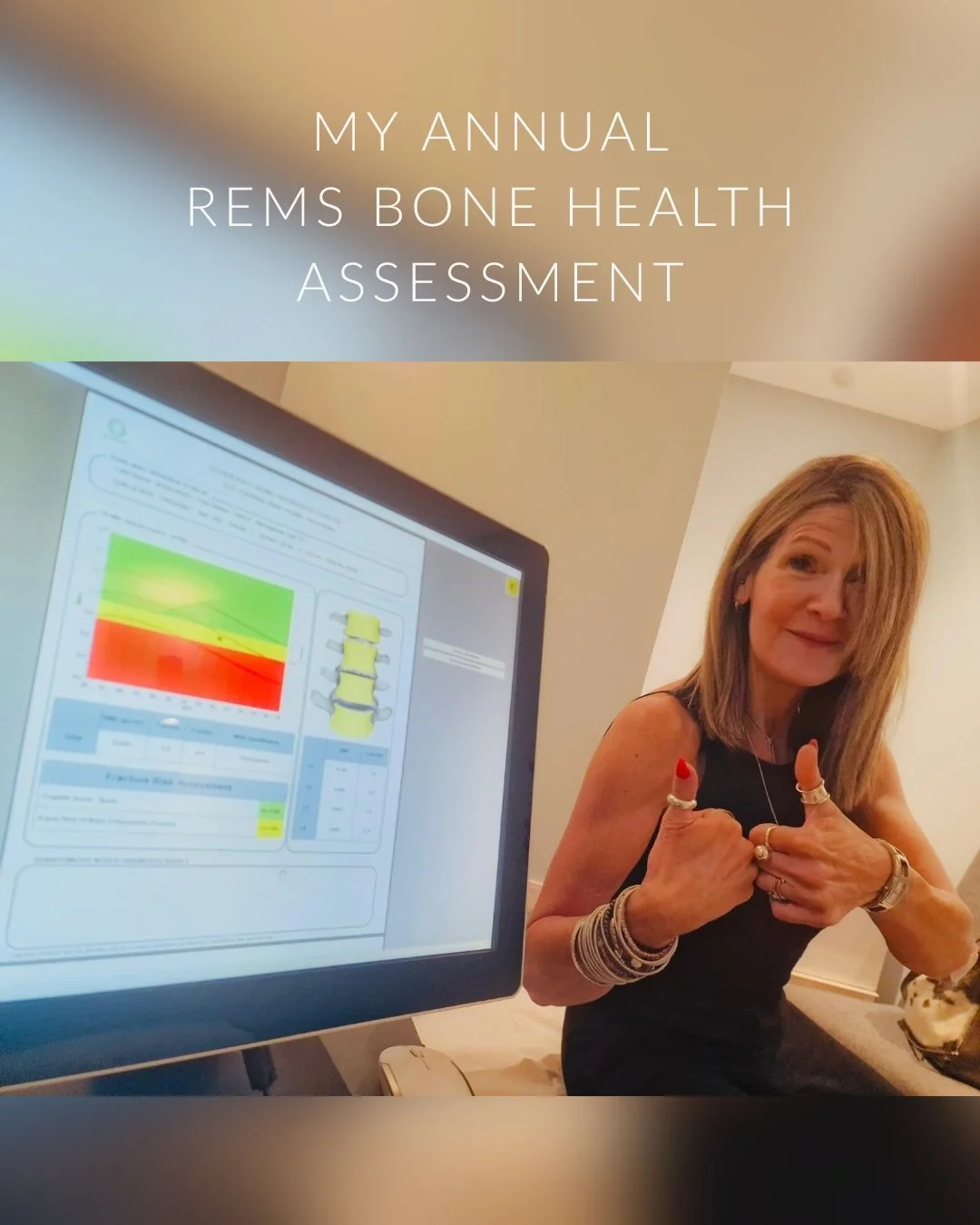 Last week I had my annual REMS bone health assessment, and as the picture might give away&hellip; it's good news 🎉

Everything I've been doing is genuinely working. Not just holding the line, actually making gains. And I want to share the results be