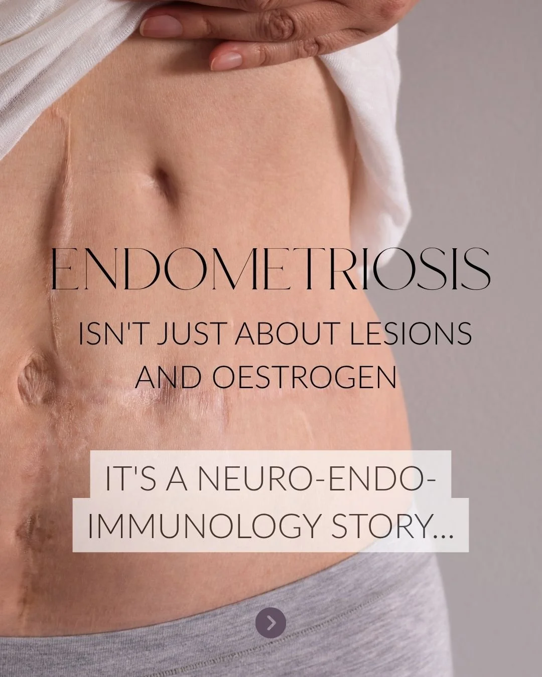 For too long we've mapped endometriosis through what we can see / measure. But if you've sat across from a woman whose pain makes no sense next to her imaging or using the staging of lesions process you'll know: the visible disease is only ever half 