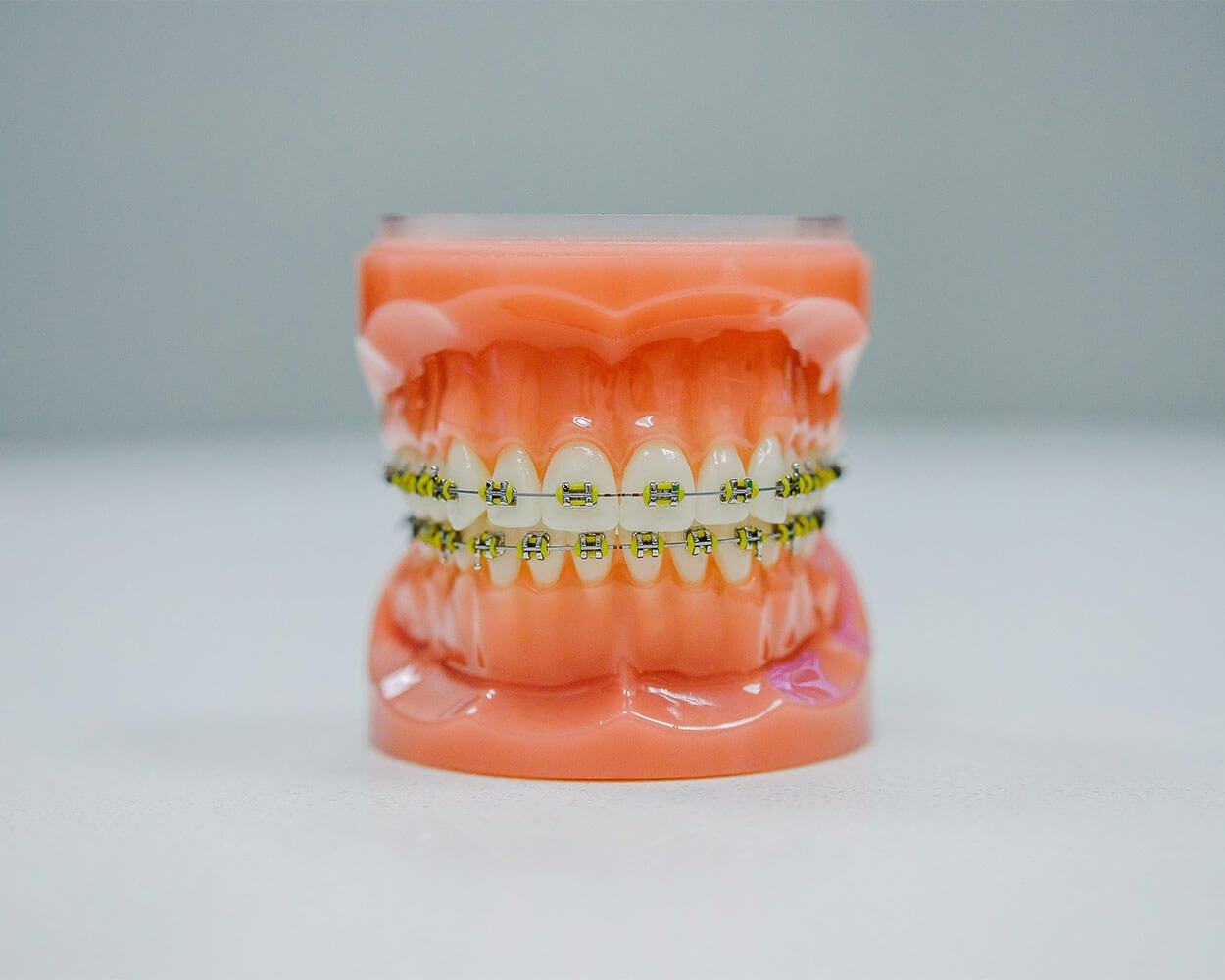 wonder, what do spots on your gums mean