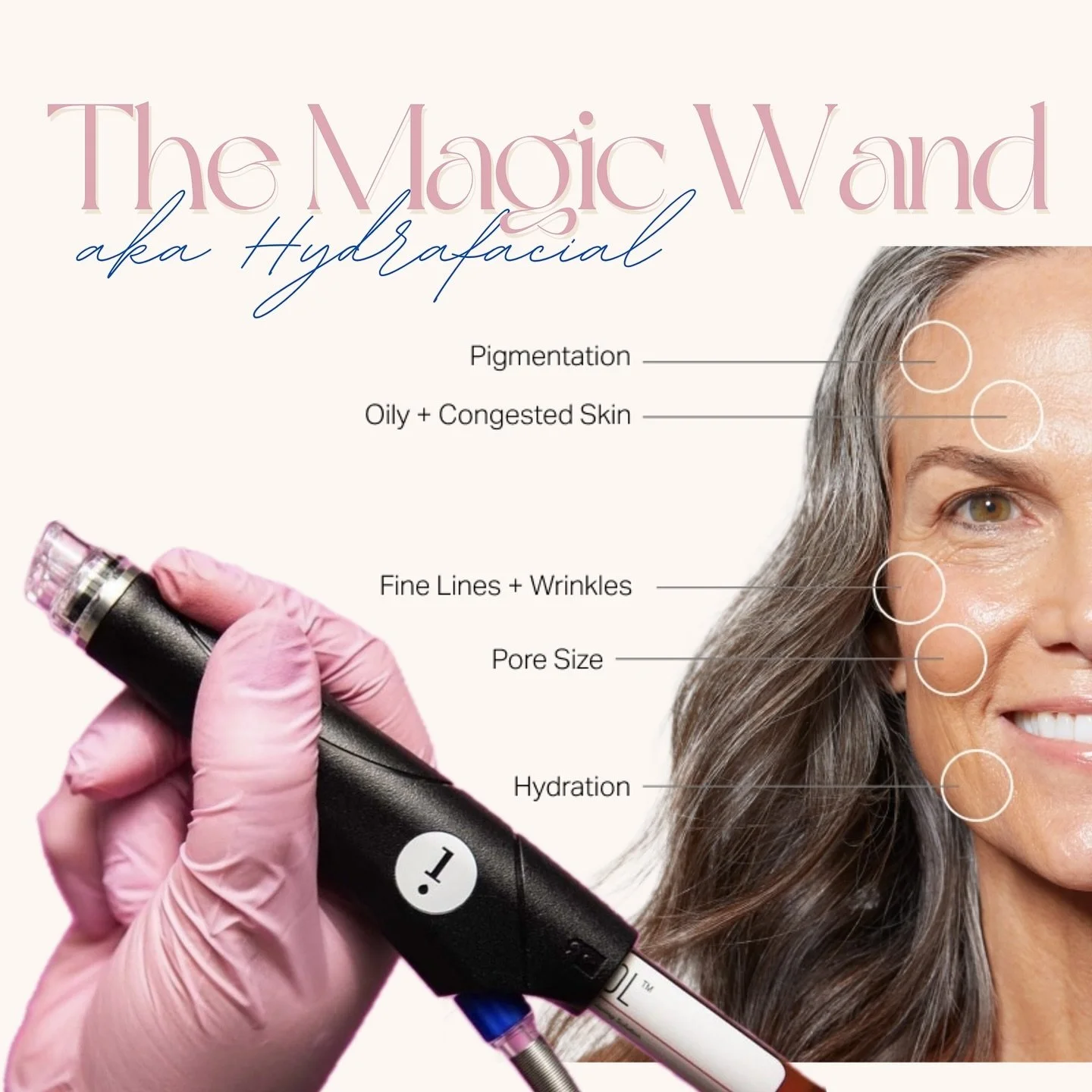 WHY BOOK A HYDRAFACIAL SESH???

Significantly Improves&hellip;

✨ Pore size - 80% reported a significant improvement in pore size - dissolved oil and detoxed pores
✨ Congestion &amp; Acne - 100%&nbsp;of participants had clearer skin with 65% achievin