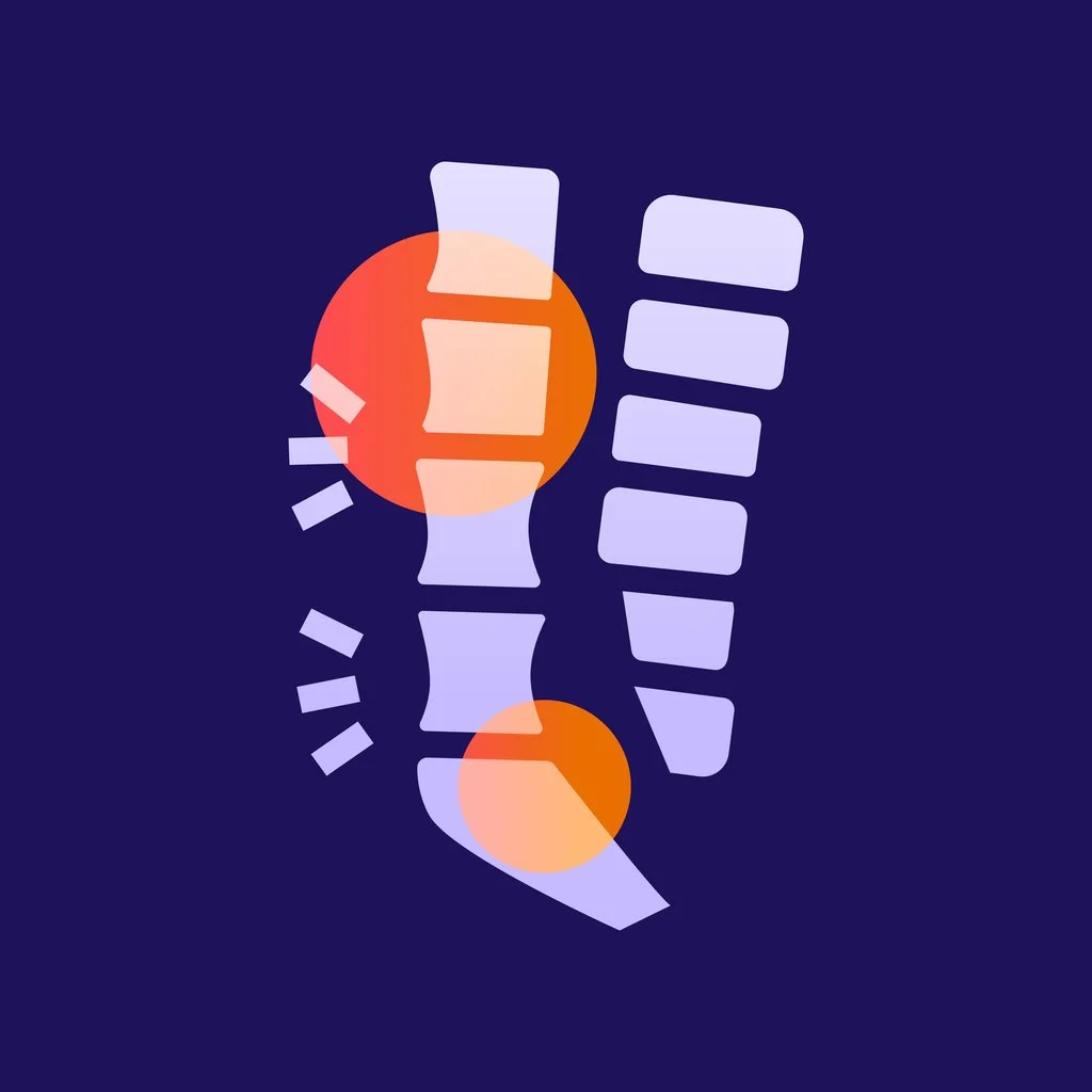 Spondylolysis and Pars Stress Fractures: A Rehab Roadmap for Active Adults