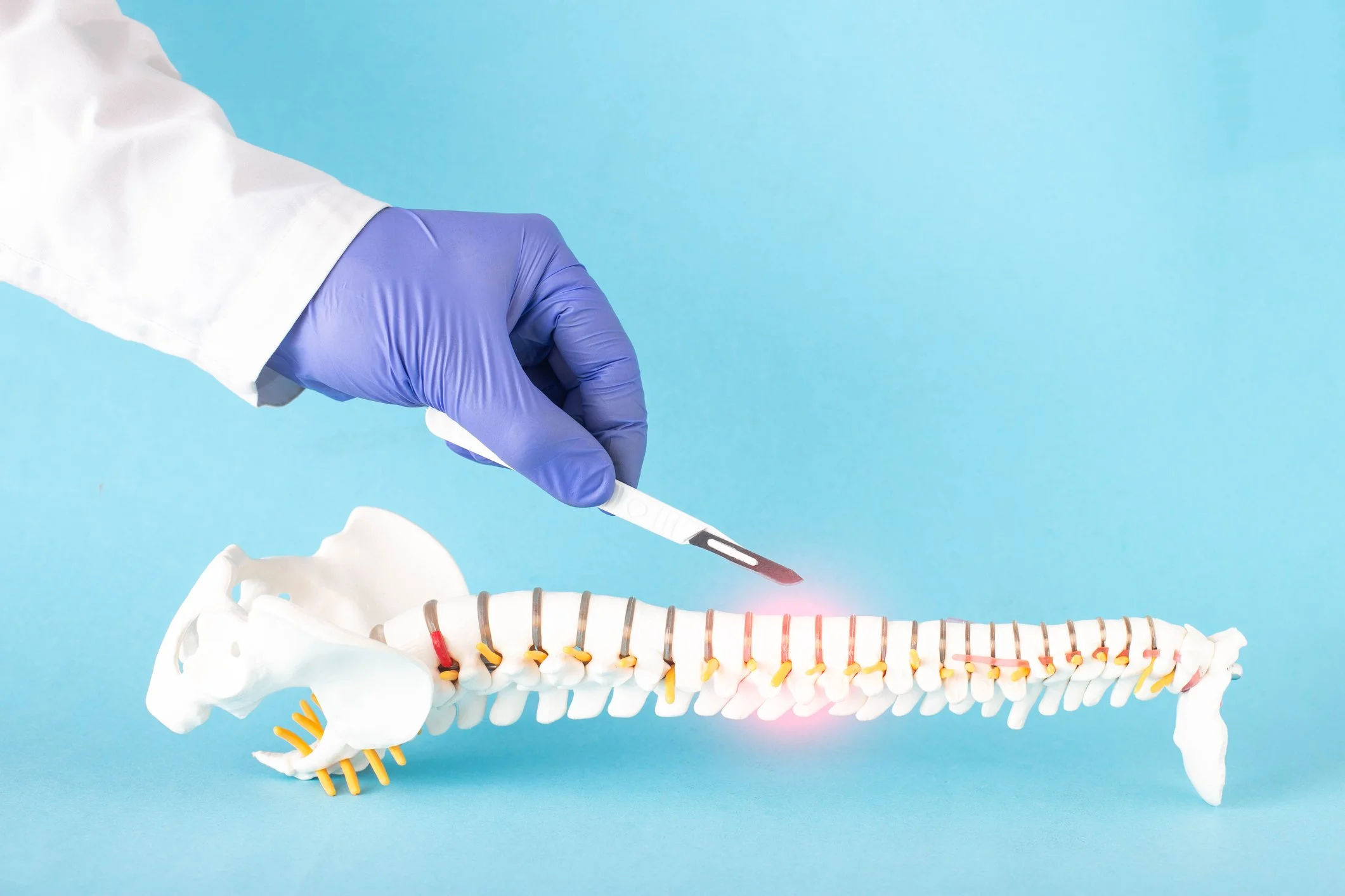 Microdiscectomy in Australia: What to Expect, Recovery Timeline, and Post-Surgery Physio