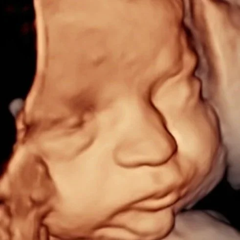 baby being born revealing gender