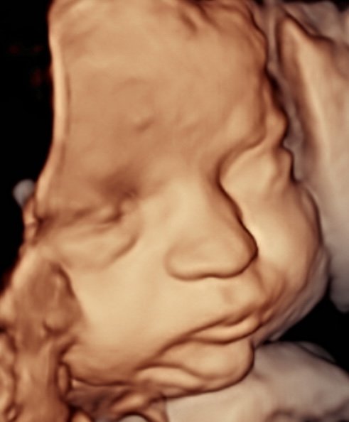 31 weeks