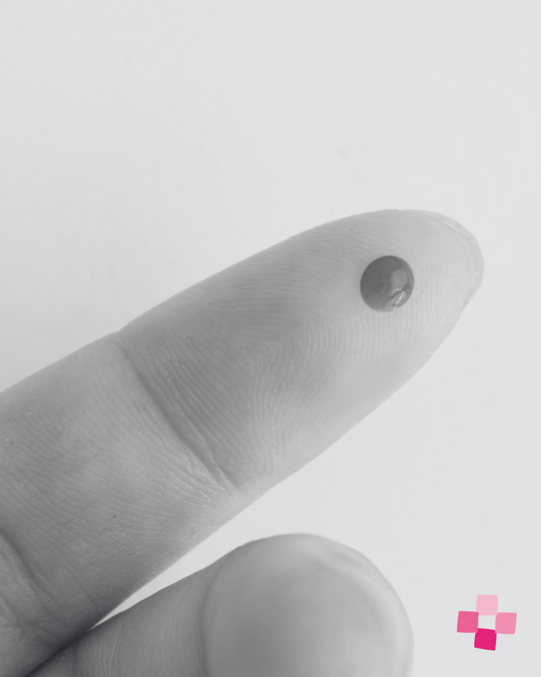 The problem with finger-prick hormone tests