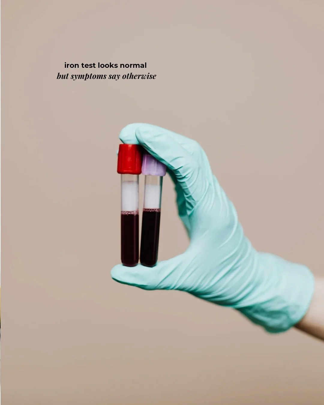Let&rsquo;s chat iron testing 🩸 

If you&rsquo;re feeling tired, foggy, anxious, have heavy periods or headaches - and bloods show all is well - that might not actually be the case at all. 

For this patient, her results showed her body wasn&rsquo;t