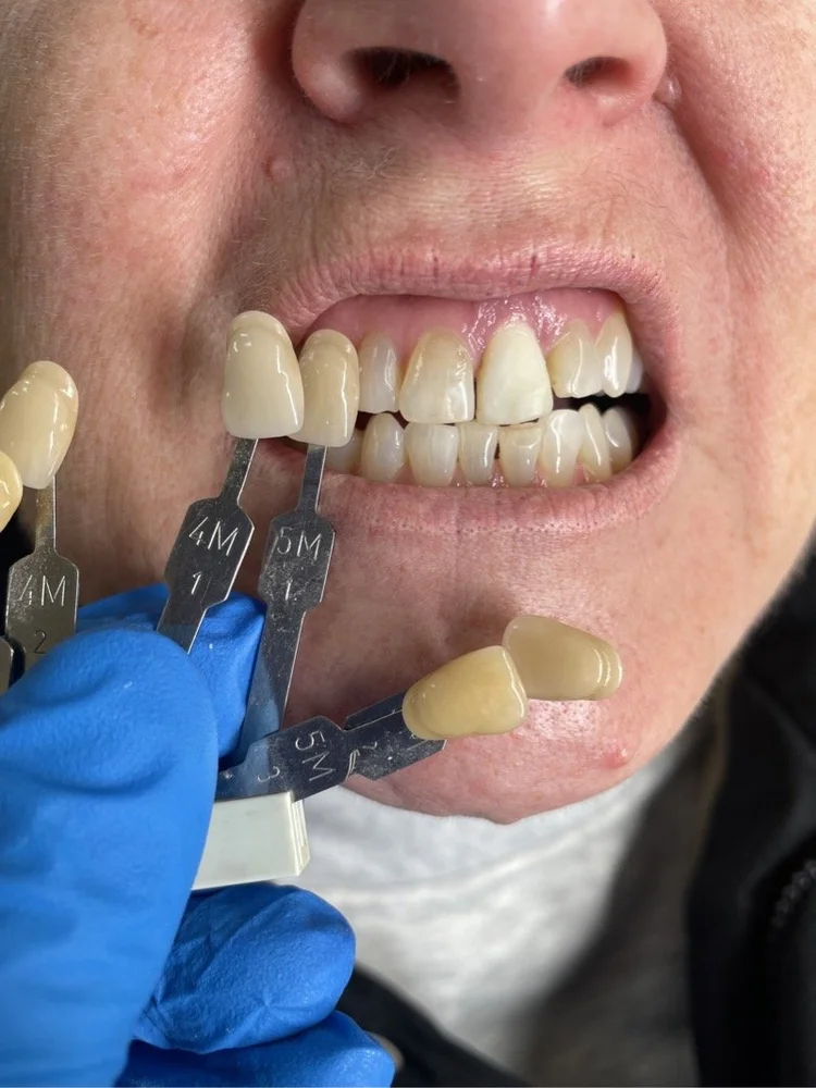 Nielsen Dental Lab