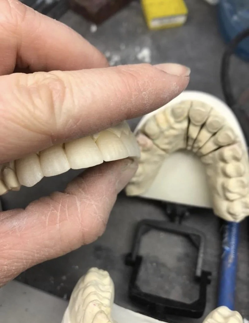 Nielsen Dental Lab
