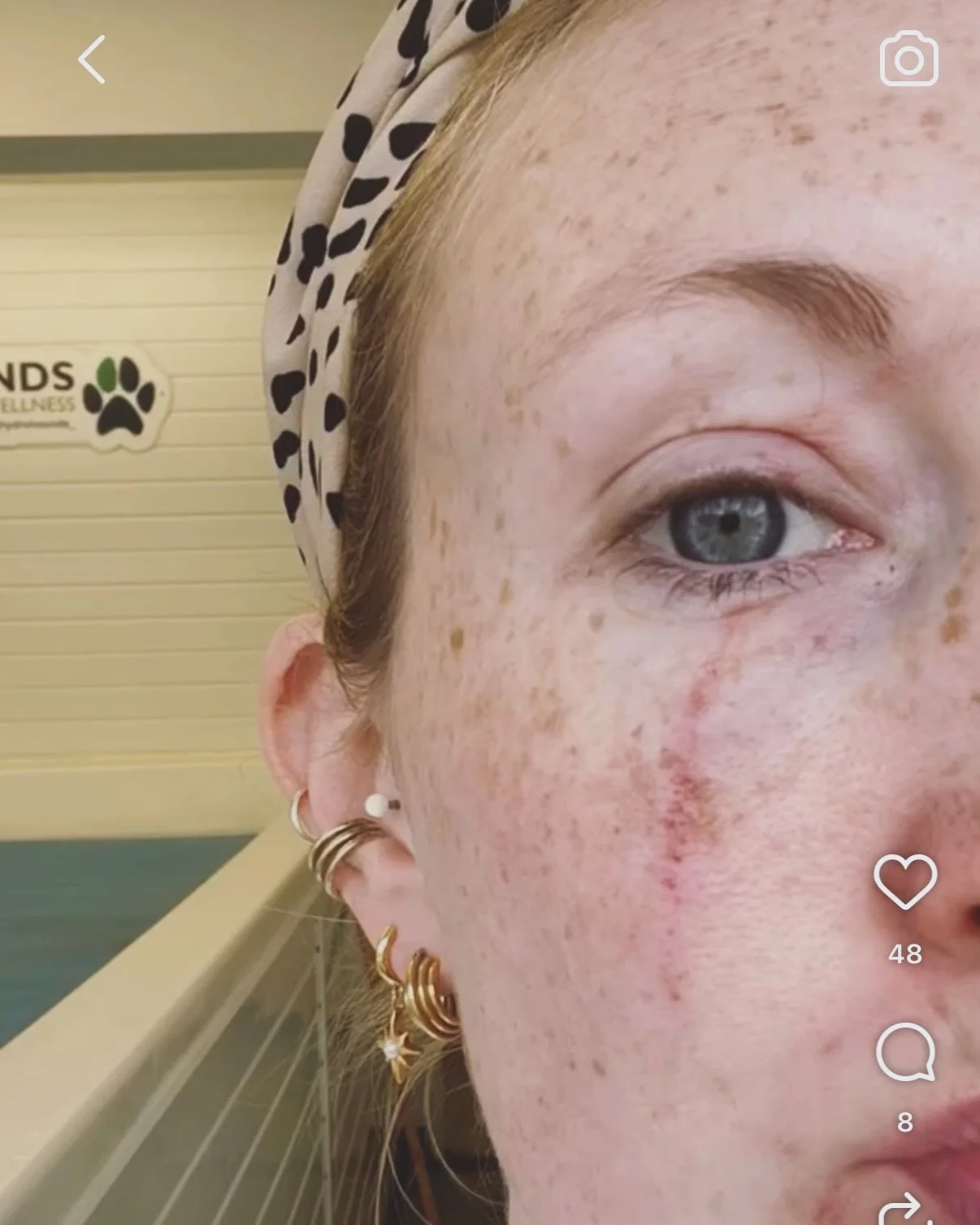 🚨INJURIES🚨 (don&rsquo;t swipe if you&rsquo;re a bit squeamish)

After Graces bite on Friday, I thought I&rsquo;d exhibit some of the injuries we&rsquo;ve had over the years. 

I&rsquo;d like the stress that not once have we turned away a dog that&r