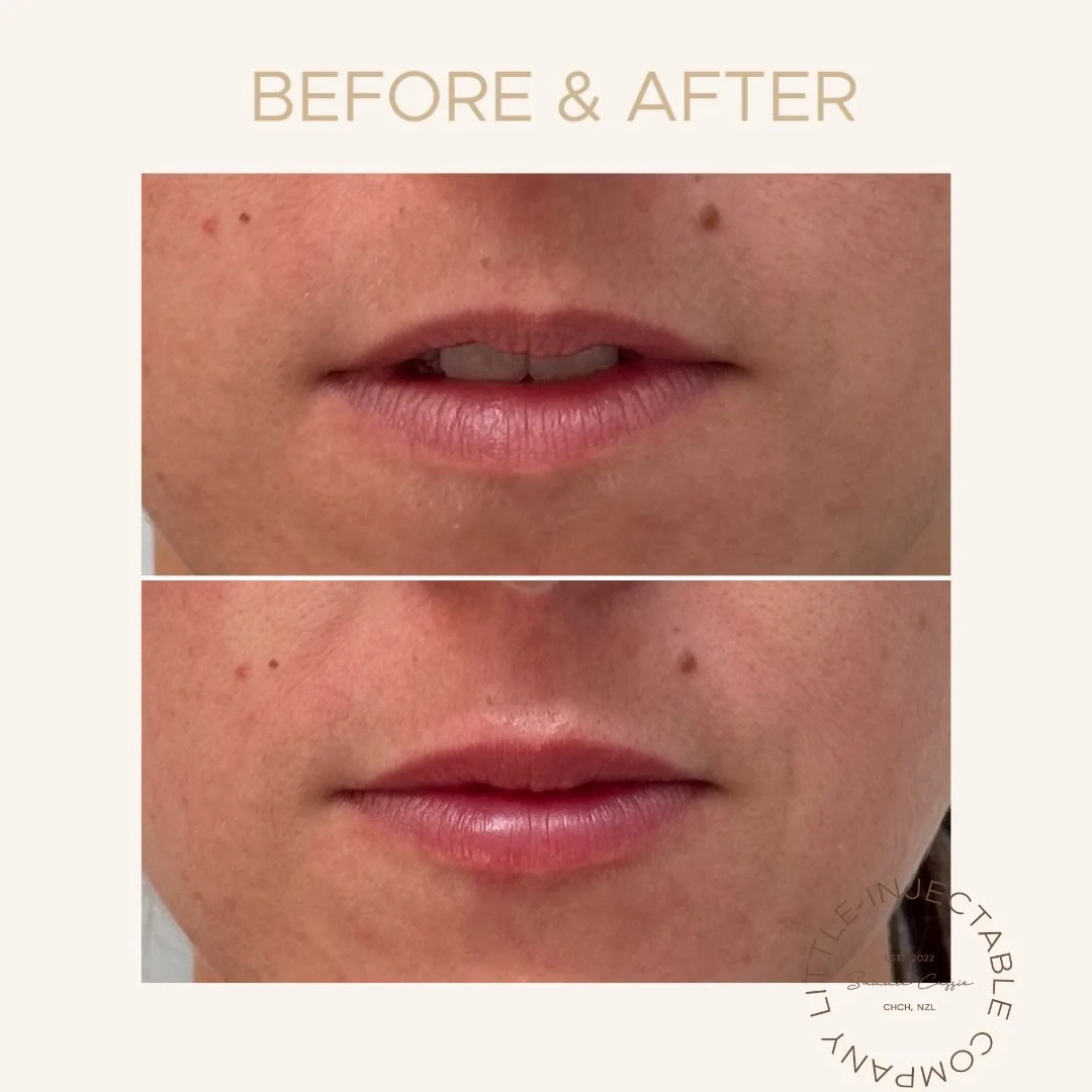 The goal was never &ldquo;done&rdquo;.
Just softer, fresher, more balanced.