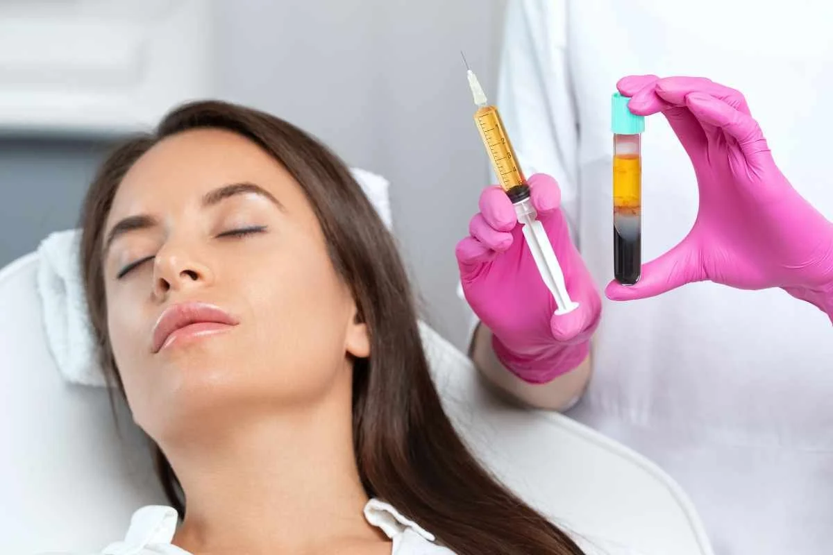 PRP Therapy for Skin