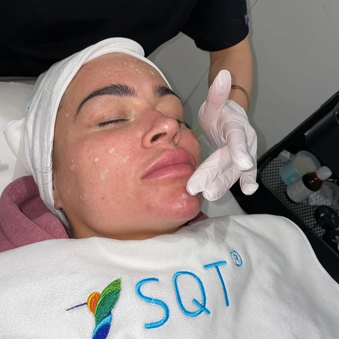 GLP-1 Skin Changes: How SQT Biomicroneedling Can Support Compromised Skin