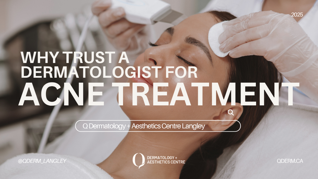 Understanding the Root Causes of Acne and How Dermatology Can Help