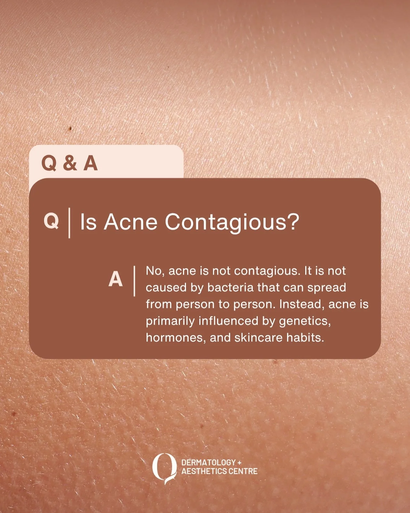 Is Acne Contagious?
Many people wonder if acne can be spread from one person to another, but the truth is acne is not contagious. It isn‘t caused by an infectious microorganism and cannot be transmitted through touch or contact.
Acne develops