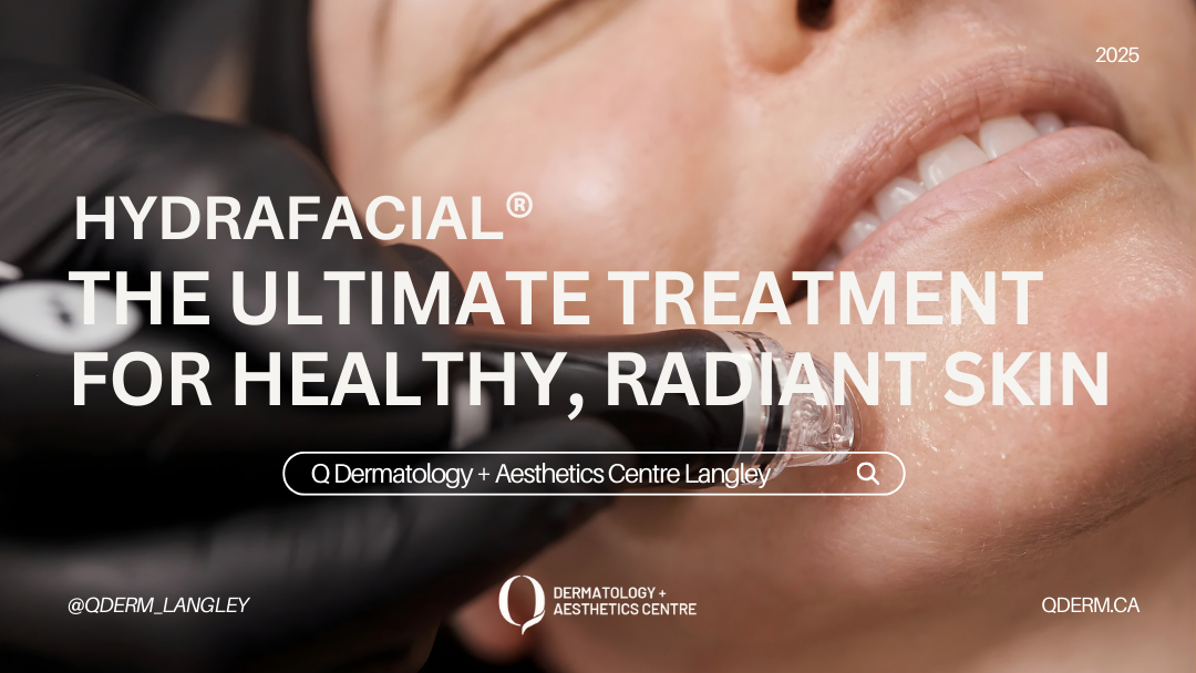 Hydrafacial: The Ultimate Treatment for Radiant, Healthy, and Refreshed Skin