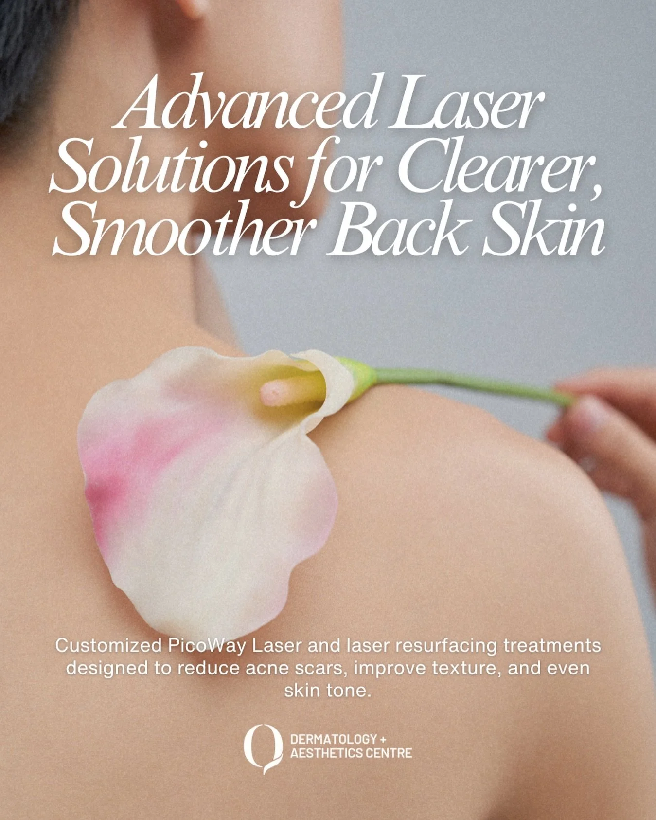 Advanced Laser Solutions for Clearer, Smoother Back Skin

Acne scars, uneven texture, and lingering pigmentation on the back can be difficult to improve with topical treatments alone. At Q Dermatology + Aesthetics Centre, we offer customized PicoWay 