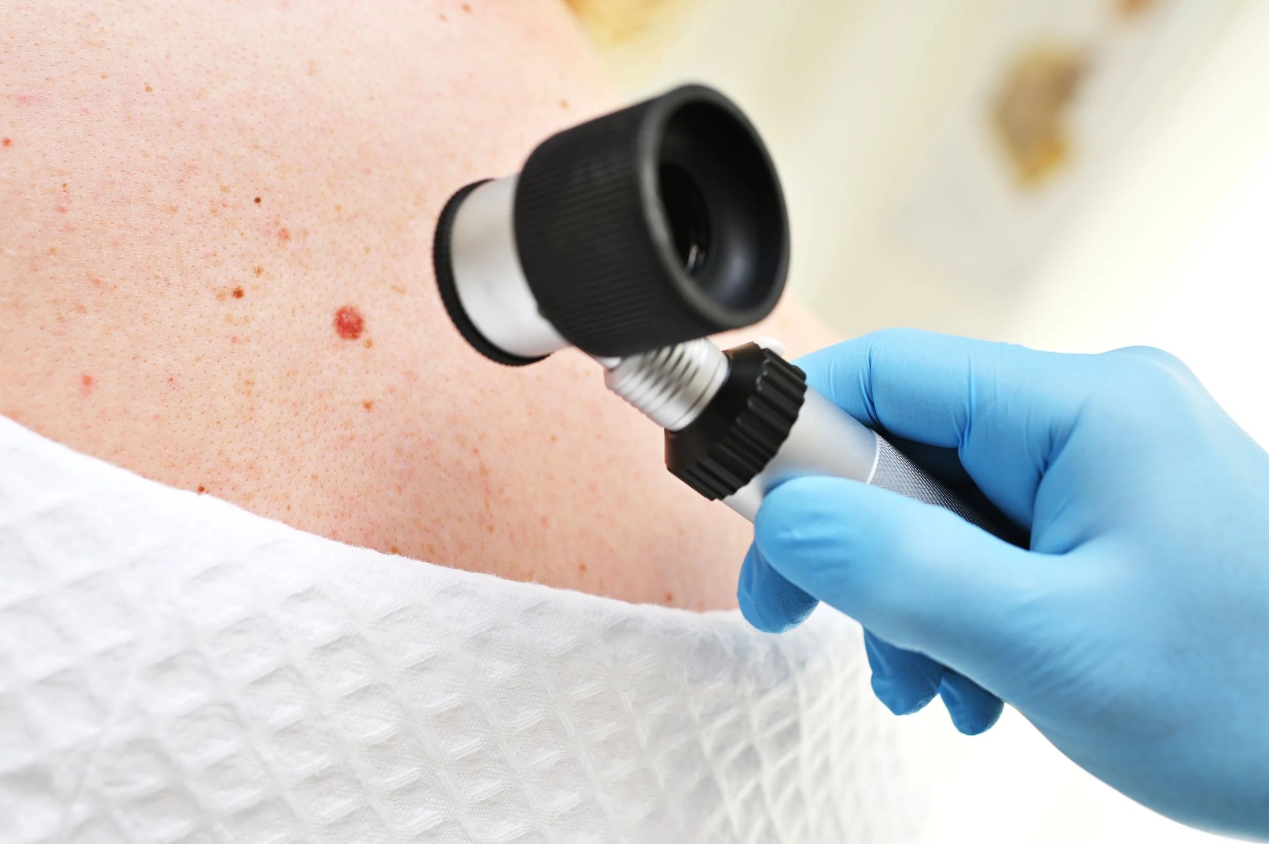 Dermatology Treatments