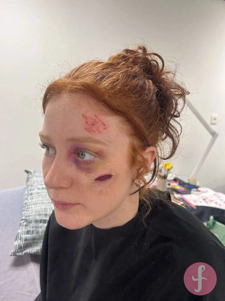 Film SFX examen ✨ een 2 dagen oude blauwe plek met schaafwonden en vechtschade onder het oog 🎬