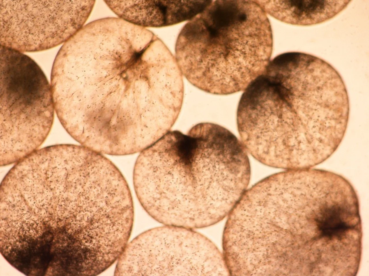 The Case of Noctiluca