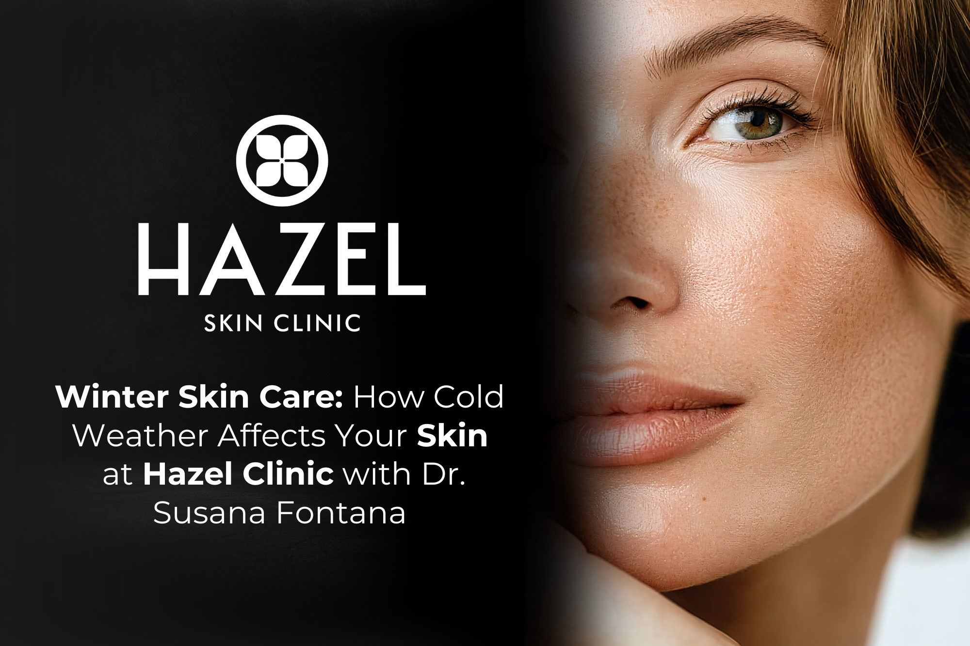Winter Skin Care: How Cold Weather Affects Your Skin — and How Dr. Susana Fontana Treats It at Hazel Clinic