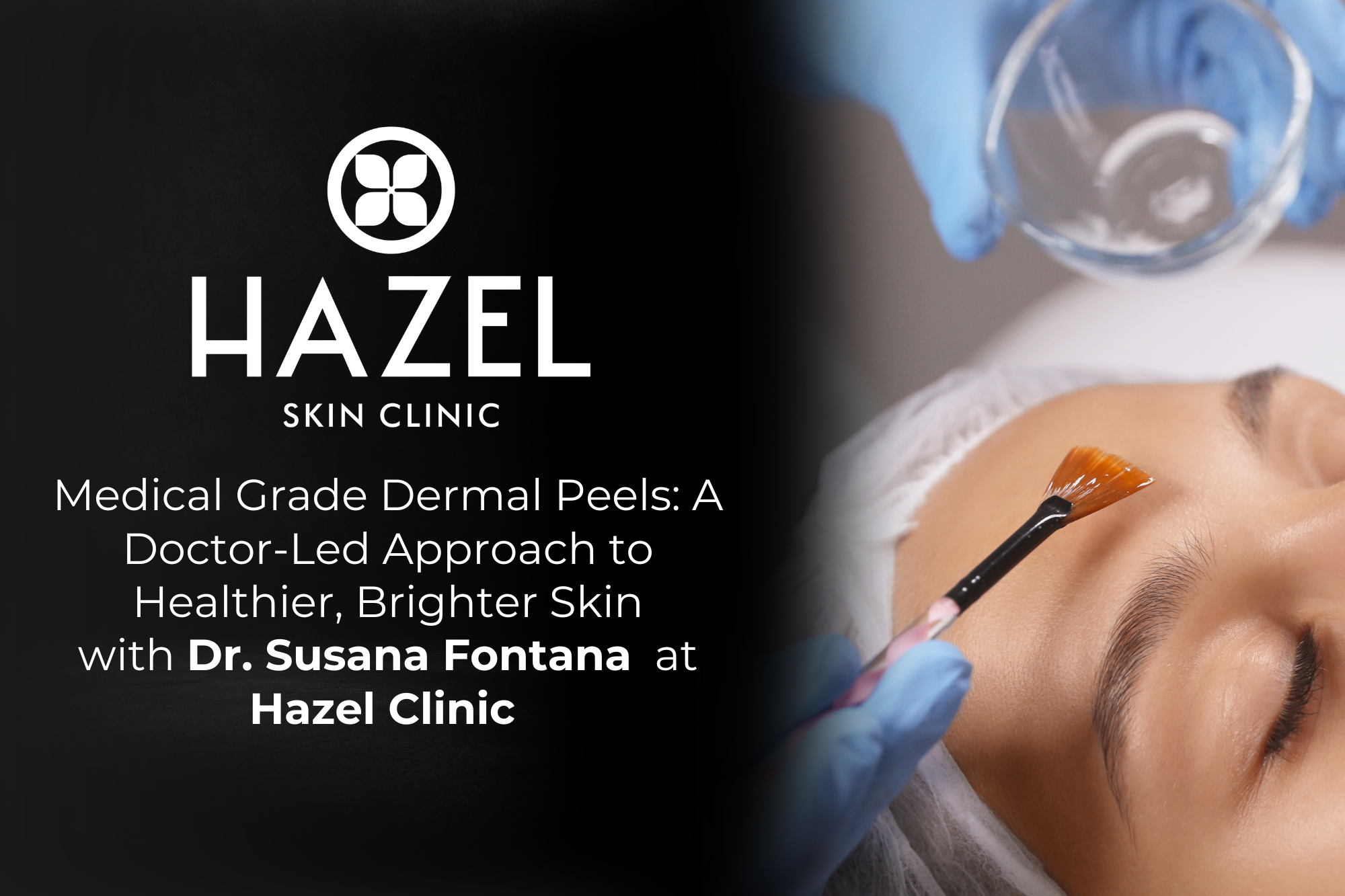 Medical Grade Dermal Peels: A Doctor-Led Approach to Healthier, Brighter Skin