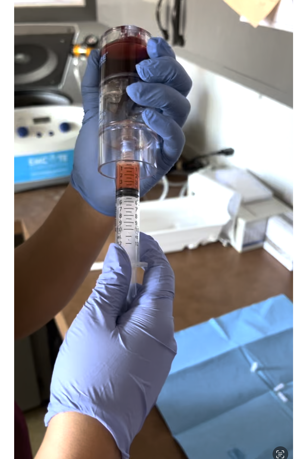 PRP and Stem Cells for joint pain